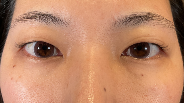 Preoperative Condition Part 1