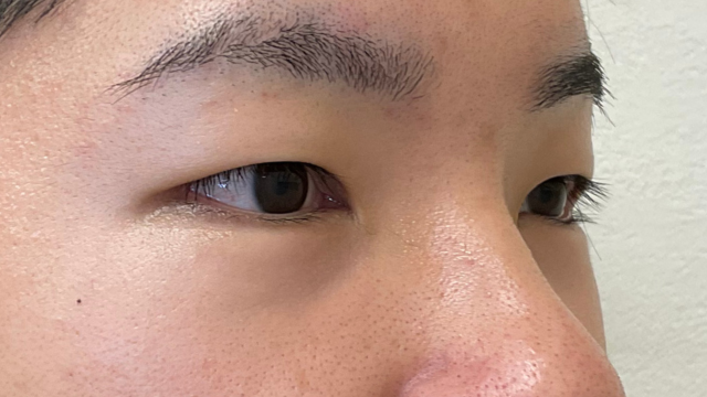 Preoperative Condition Part 1