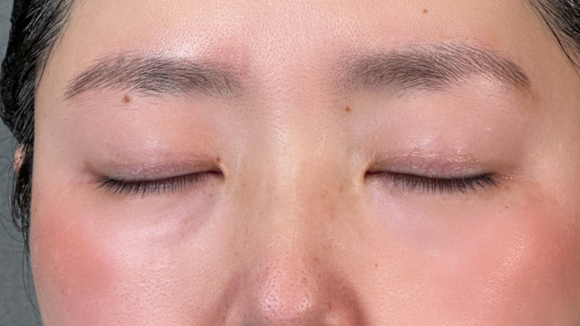 Preoperative Condition Part 1