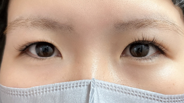 Preoperative Condition Part 1