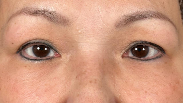 Preoperative Condition Part 1