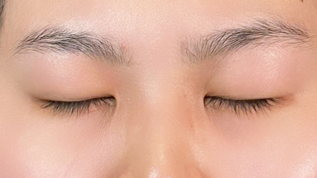 Preoperative Condition Part 1