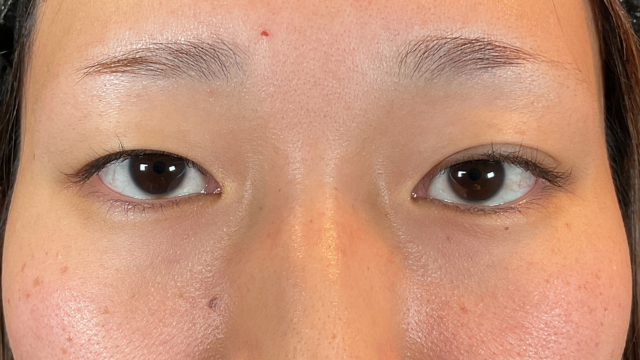 Preoperative Condition Part 1