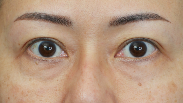 Preoperative Condition Part 1