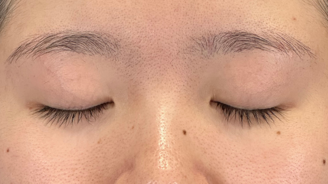 Preoperative Condition Part 1