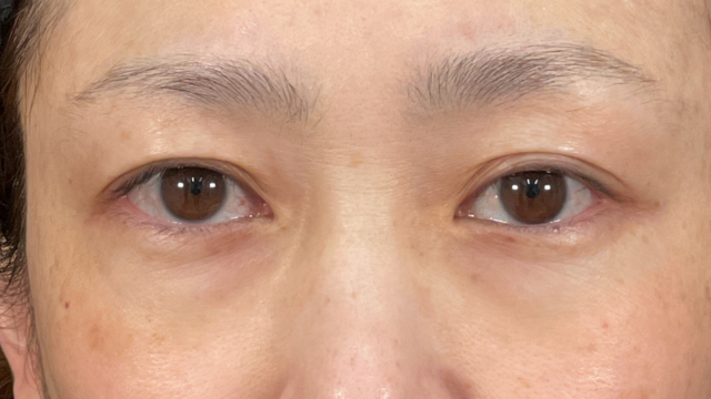 Preoperative Condition Part 1