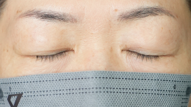 Preoperative Condition Part 1