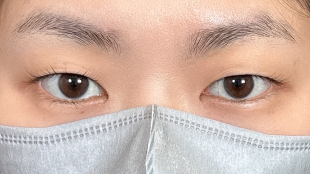 Preoperative Condition Part 1