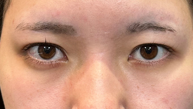 Preoperative Condition Part 1