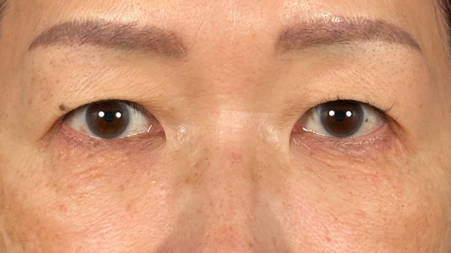 Preoperative Condition Part 1