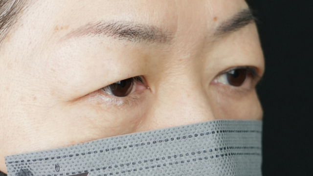 Preoperative Condition Part 1