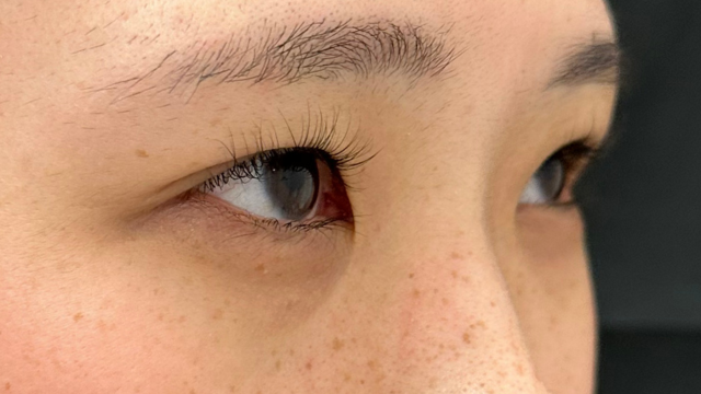 Preoperative Condition Part 1