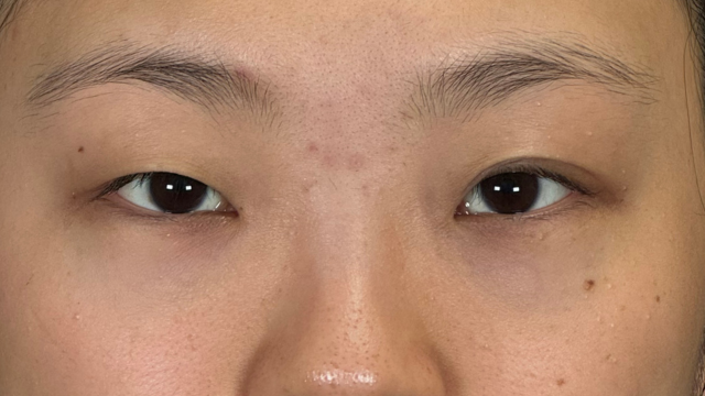 Preoperative Condition Part 1