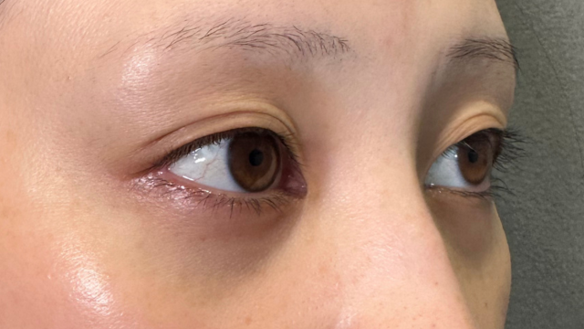 Preoperative Condition Part 1