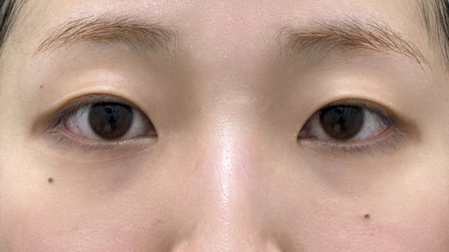 Preoperative Condition Part 1