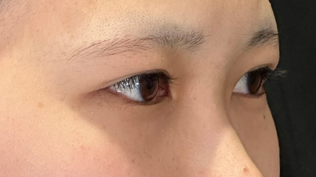 Preoperative Condition Part 1