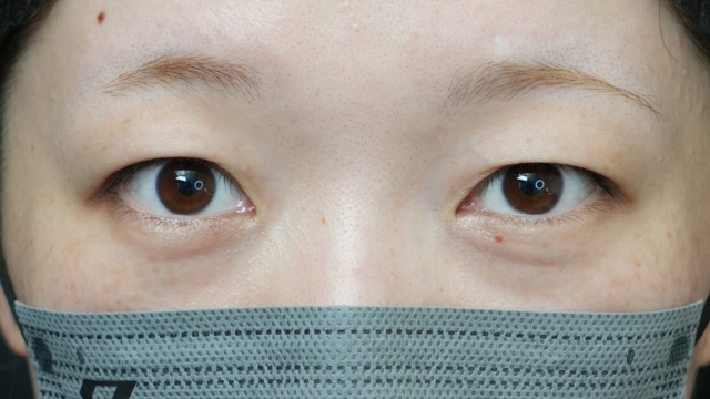 Preoperative Condition Part 1