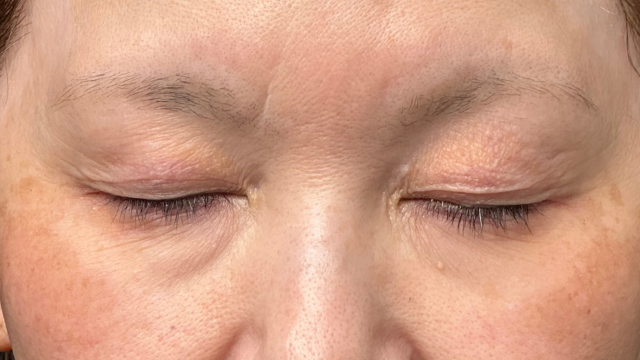 Preoperative Condition Part 1