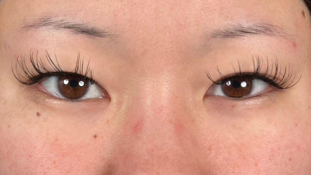 Preoperative Condition Part 1