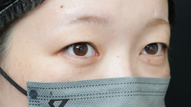 Preoperative Condition Part 1