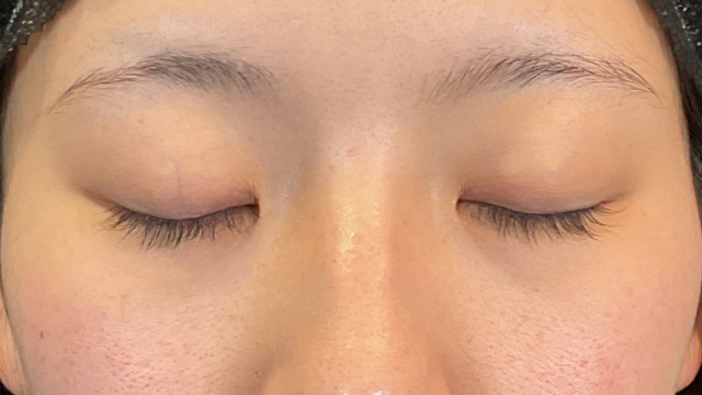 Preoperative Condition Part 1