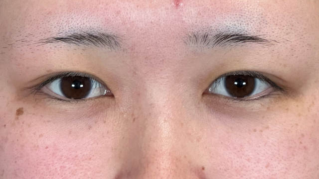 Preoperative Condition Part 1