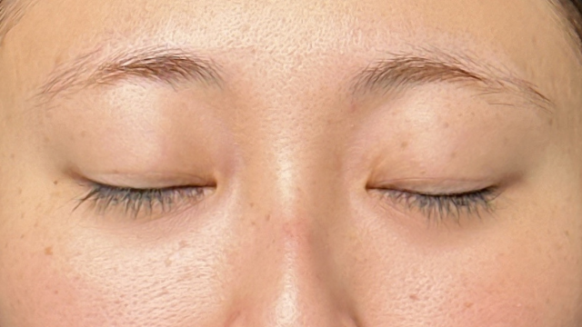 Preoperative Condition Part 1