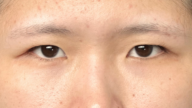 Preoperative Condition Part 1