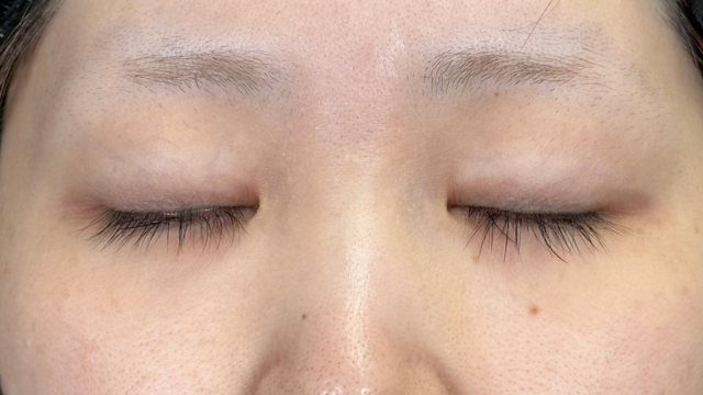 Preoperative Condition Part 1