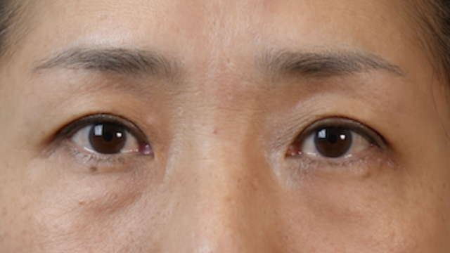 Preoperative Condition Part 1