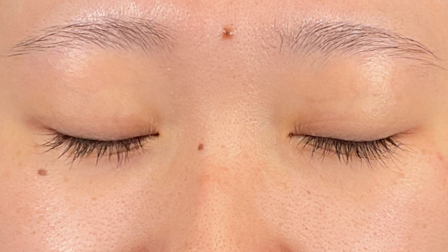 Preoperative Condition Part 1