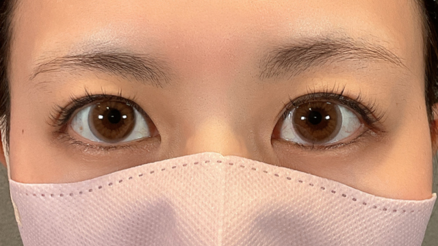 Preoperative Condition Part 1