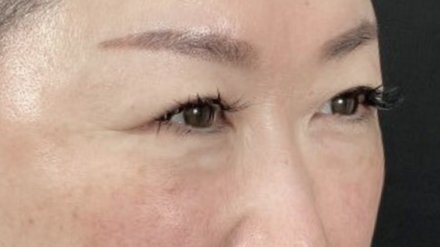 Preoperative Condition Part 1