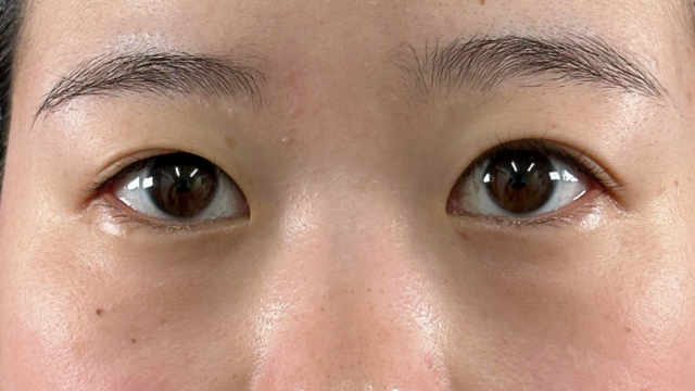 Preoperative Condition Part 1