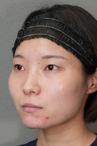 Preoperative Condition Part 1