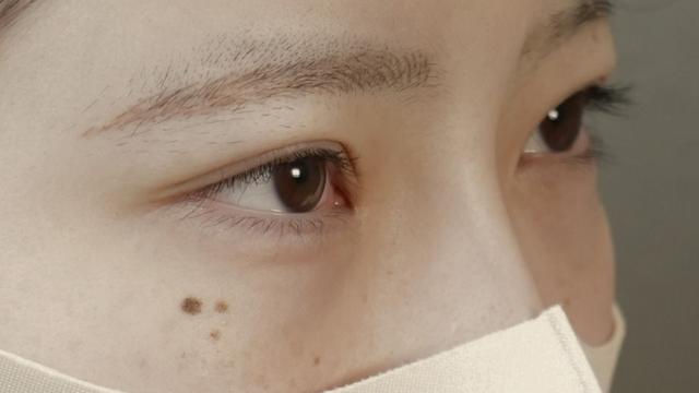 Preoperative Condition Part 1