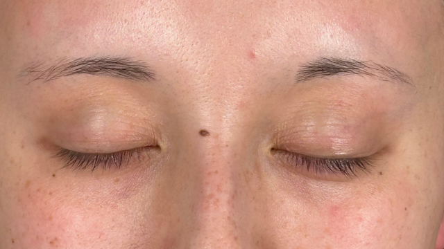 Preoperative Condition Part 1