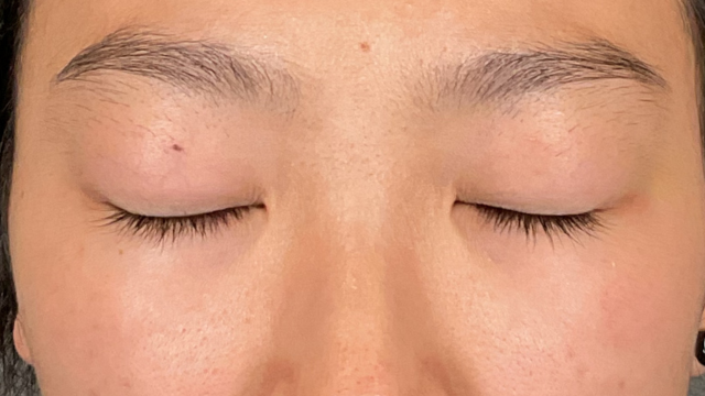 Preoperative Condition Part 1