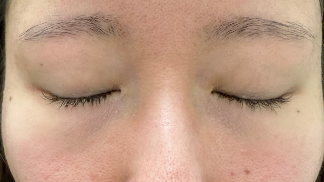 Preoperative Condition Part 1