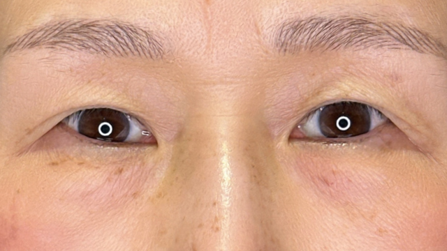 Preoperative Condition Part 1