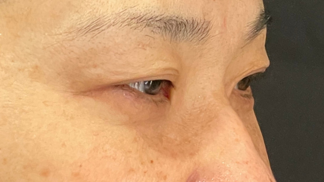 Preoperative Condition Part 1