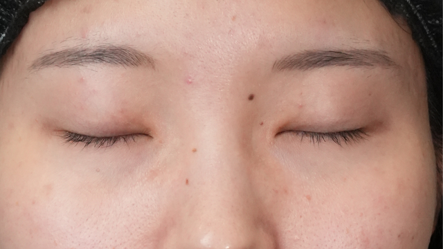 Preoperative Condition Part 1