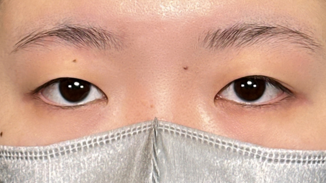 Preoperative Condition Part 1