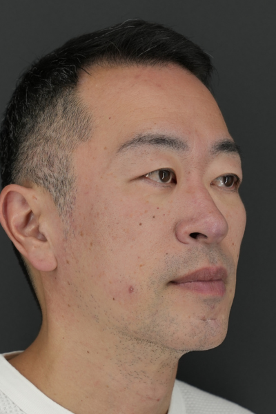 Preoperative Condition Part 1