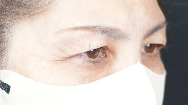 Preoperative Condition Part 1