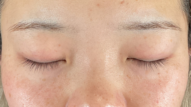 Preoperative Condition Part 1