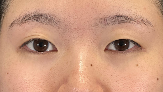 Preoperative Condition Part 1