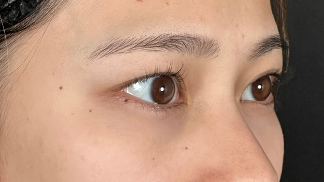 Preoperative Condition Part 1