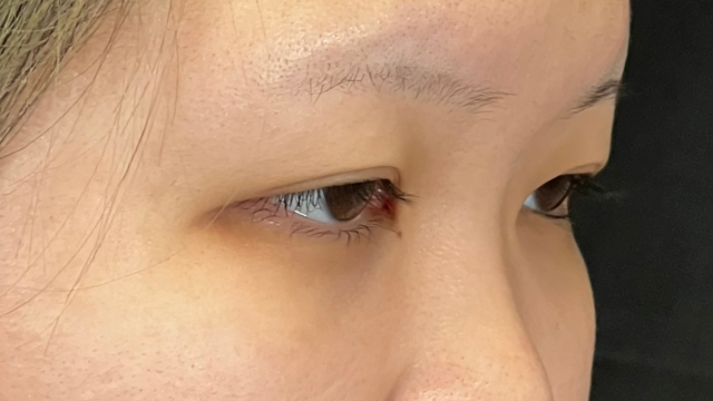 Preoperative Condition Part 1