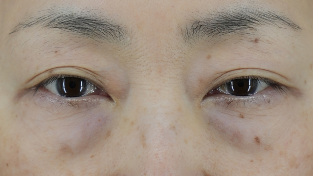 Preoperative Condition Part 1